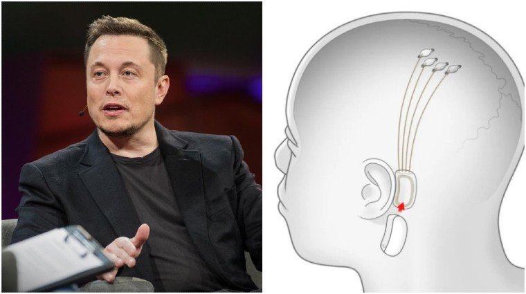 Elon Musk - Neuralink